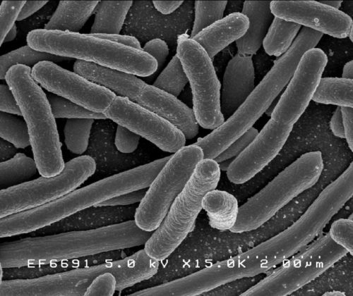 Bacteria seen with a microscope.