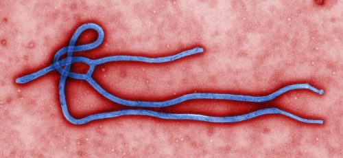 Ebola virus seen under an electron-scanning microscope.