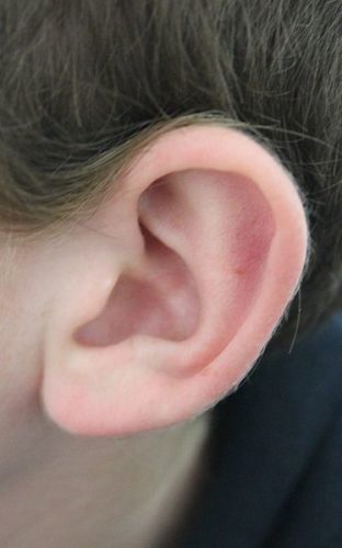 Cartilage gives shape to the outer part of the human ear.