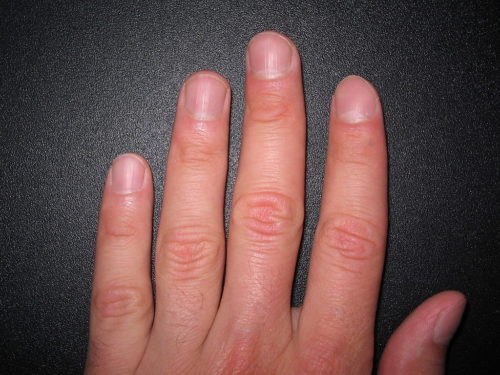 Human fingernails usually grow about an inch and a half (3.6 centimeters) a year.