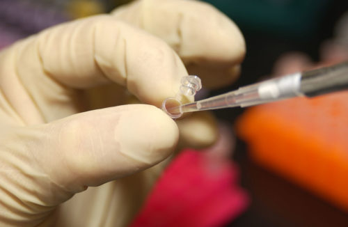 Researcher uses a pipette to remove DNA from a micro test tube.