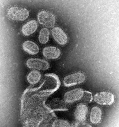 This picture shows the flu virus from 1918 about 100,000 times larger than it is in real life.