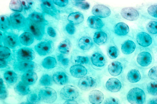 Stomach Cells that are Non-malignant