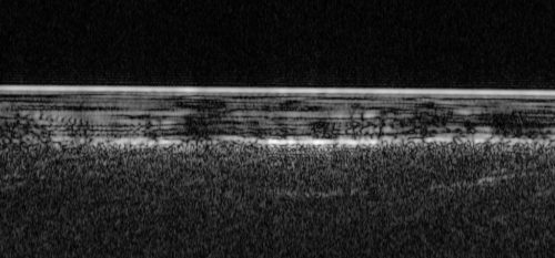 ESA’s Mars Express has used radar signals bounced through underground layers of ice to identify a pond of water buried below the surface.