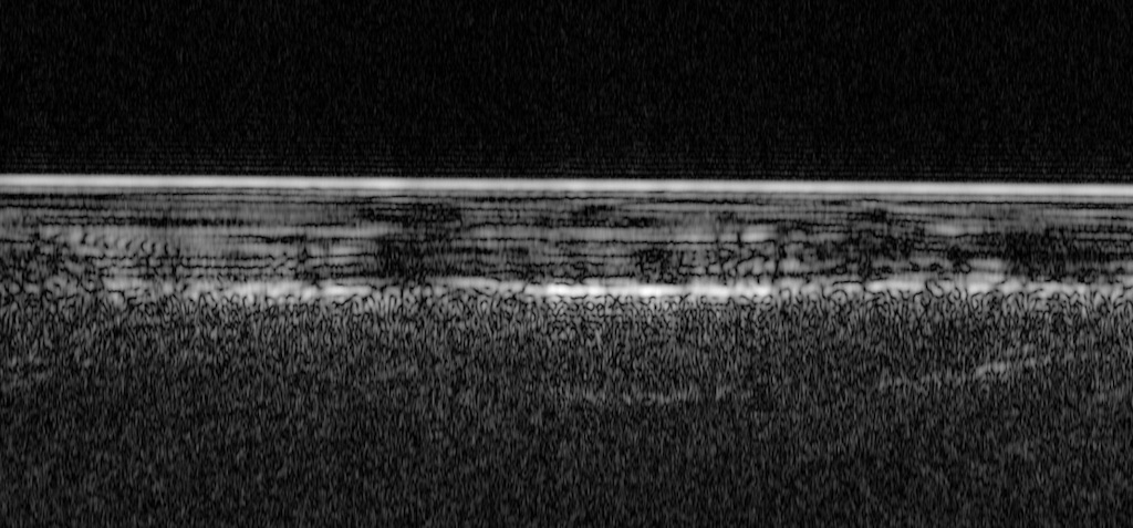ESA’s Mars Express has used radar signals bounced through underground layers of ice to identify a pond of water buried below the surface.