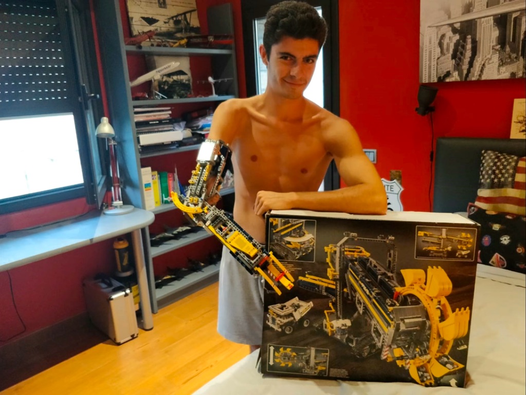 Refinement blok gispende Teenager Builds Replacement Arm From Lego