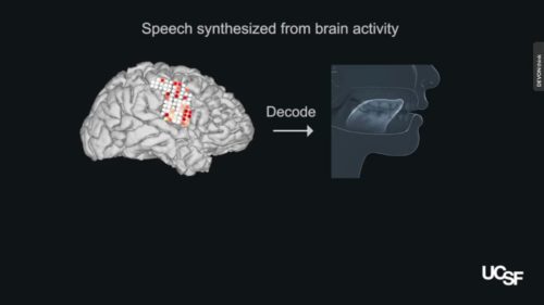 Screen shot of video showing brain signals controlling an artificial vocal tract.