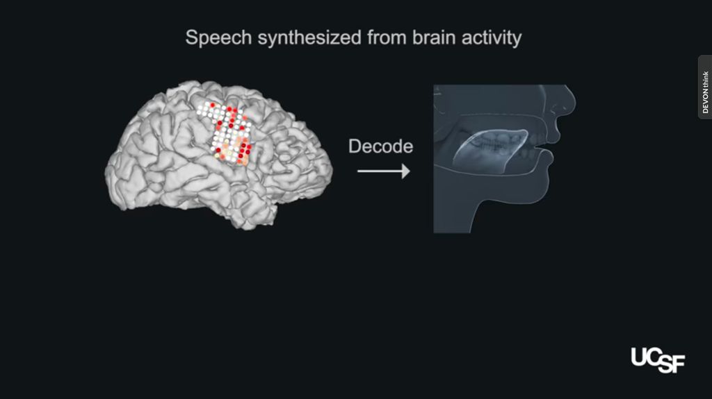 Screen shot of video showing brain signals controlling an artificial vocal tract.