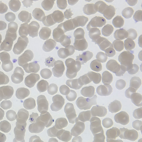 "Ring forms" of the Plasmodium falciparum (malaria) parasite, inside red blood cells.
