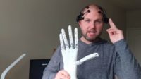 Glenn Cameron, wearing a brain interface, holds his robotic hand.