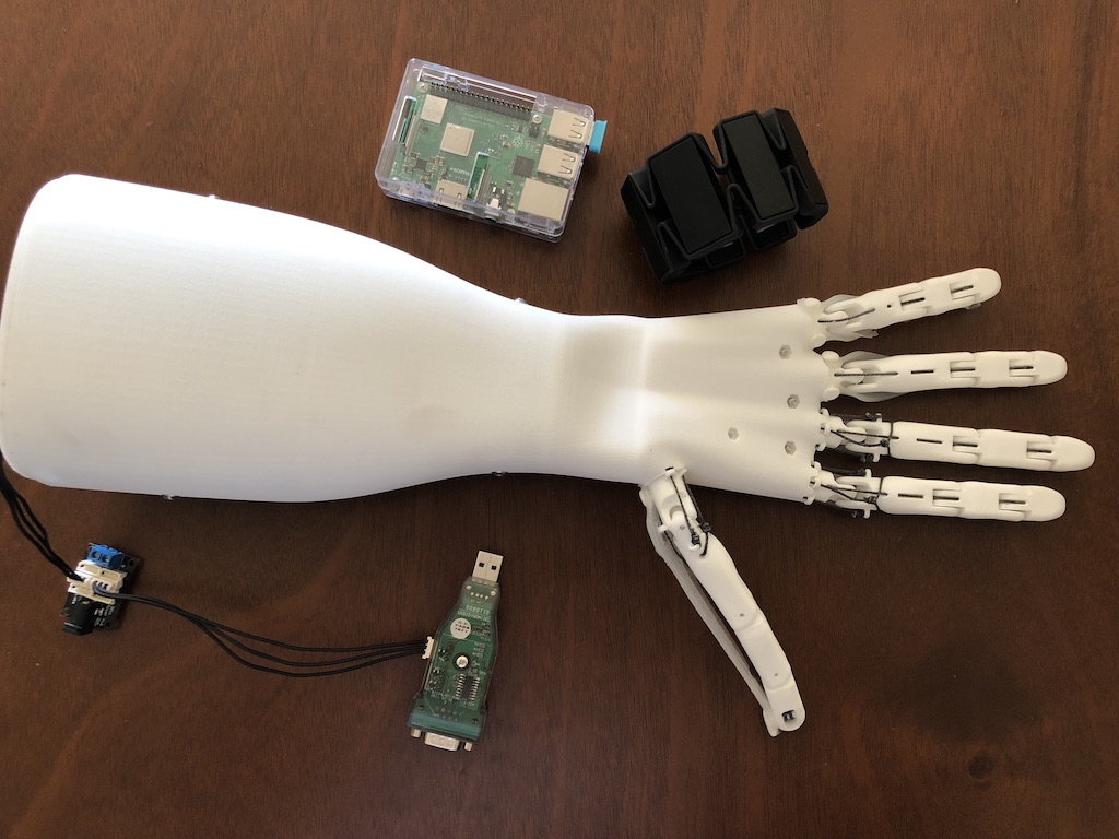 Glenn Cameron's robotic hand.