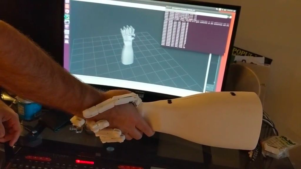 Shaking hands with Glenn Cameron's robotic hand.