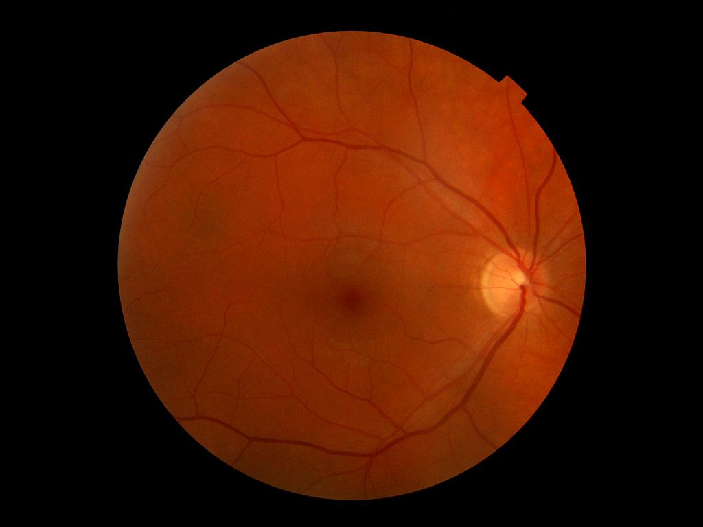 Retina of the human eye. The light circle is where the optic nerve exits the retina.