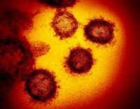 Picture of the coronavirus SARS-CoV-2 virus under an electron microscope.