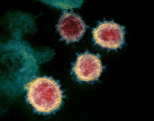 The microscopic view of the virus which causes Coronavirus disease.