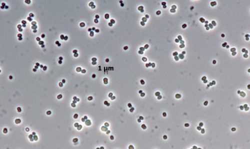 Staphylococcus hominis