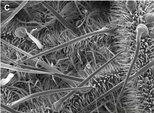 A magnified view of the trichomes - needle-like hairs - on a gympie-gympie tree.