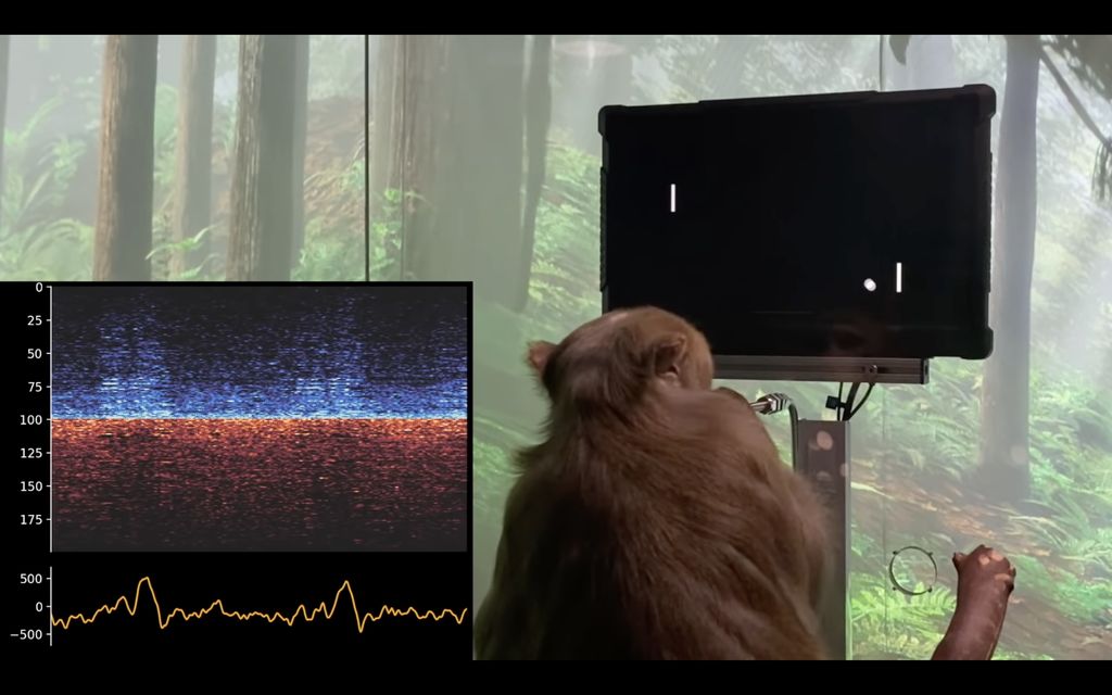 Pager plays a video game. A scan of his brain signals is overlaid in one corner of the frame.