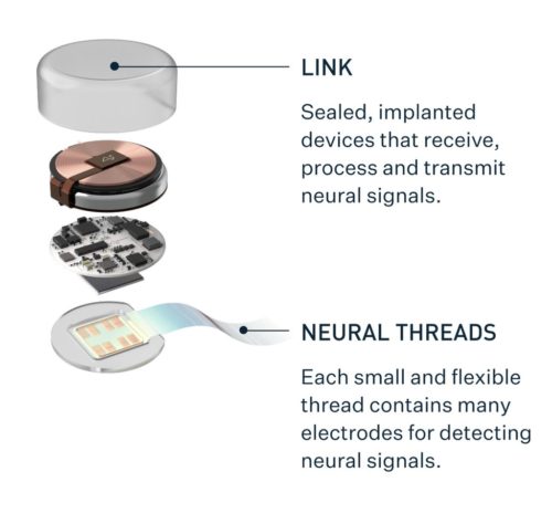 Graphic illustrating the components of Neuralink's Link device.