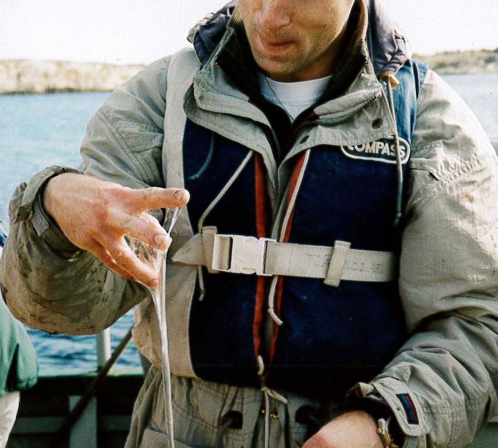 A man with sea snot dripping from one of his hands.