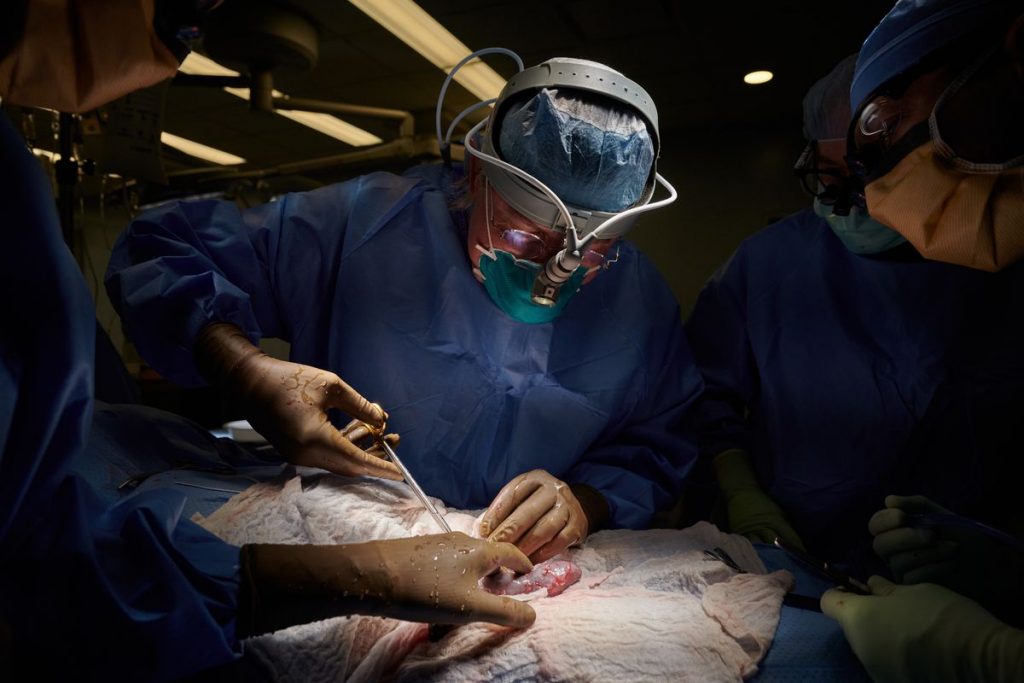 Dr. Robert Montgomery, the H. Leon Pachter, MD, Professor and chair of the Department of Surgery at NYU Langone and director of its Transplant Institute, performs the first xenotransplantation of a genetically engineered nonhuman kidney to a human at NYU Langone Health.