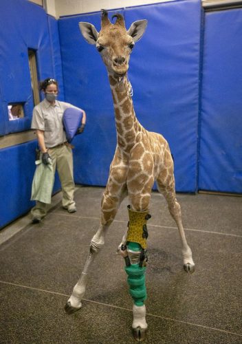 Msituni, with giraffe-patterned leg brace created by Hanger Clinic.
