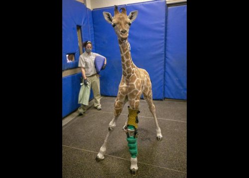 Msituni, with giraffe-patterned leg brace created by Hanger Clinic.