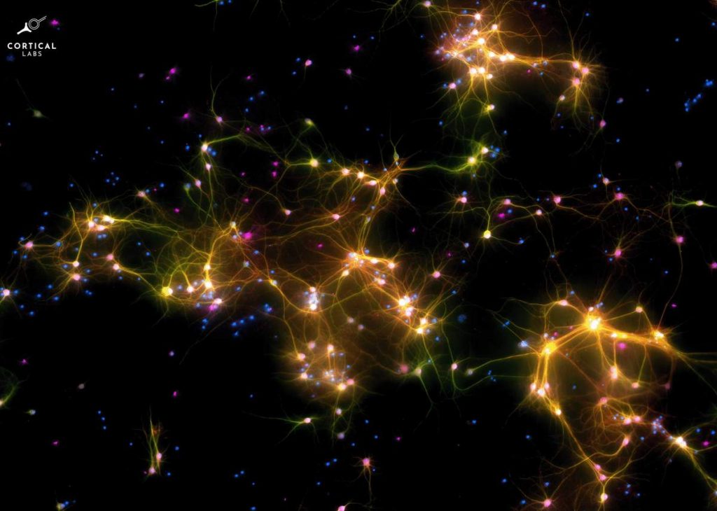 ‘Dishbrain’ under the microscope. A microscopy image of neural cells where fluorescent markers show different types of cells. Green marks neurons and axons, purple marks neurons, red marks dendrites, and blue marks all cells. Where multiple markers are present, colours are merged and typically appear as yellow or pink depending on the proportion of markers.