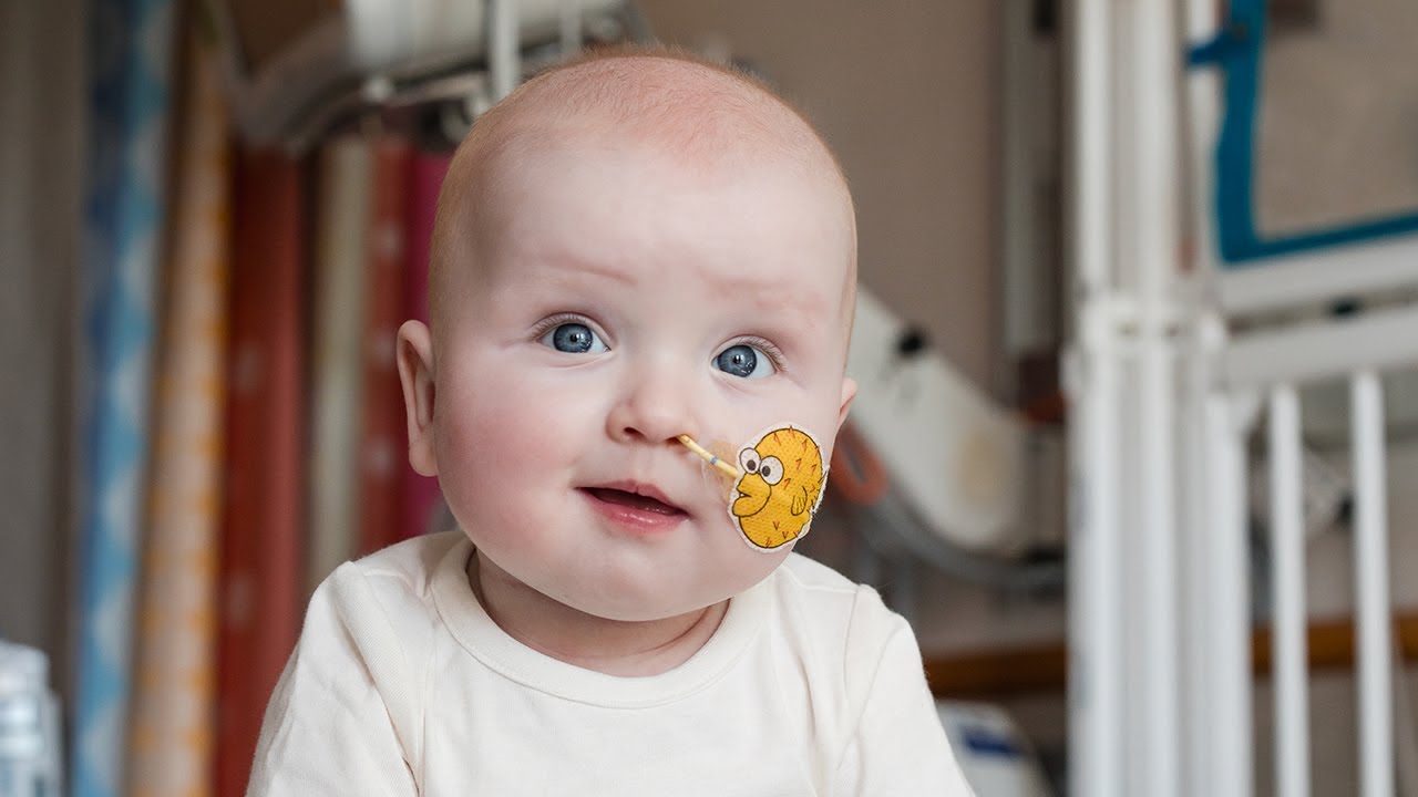 A smiling young baby looks toward the camera. A sticker of a yellow cartoon pufferfish on his left cheek holds a tube in place, which enters the baby's left nostril.