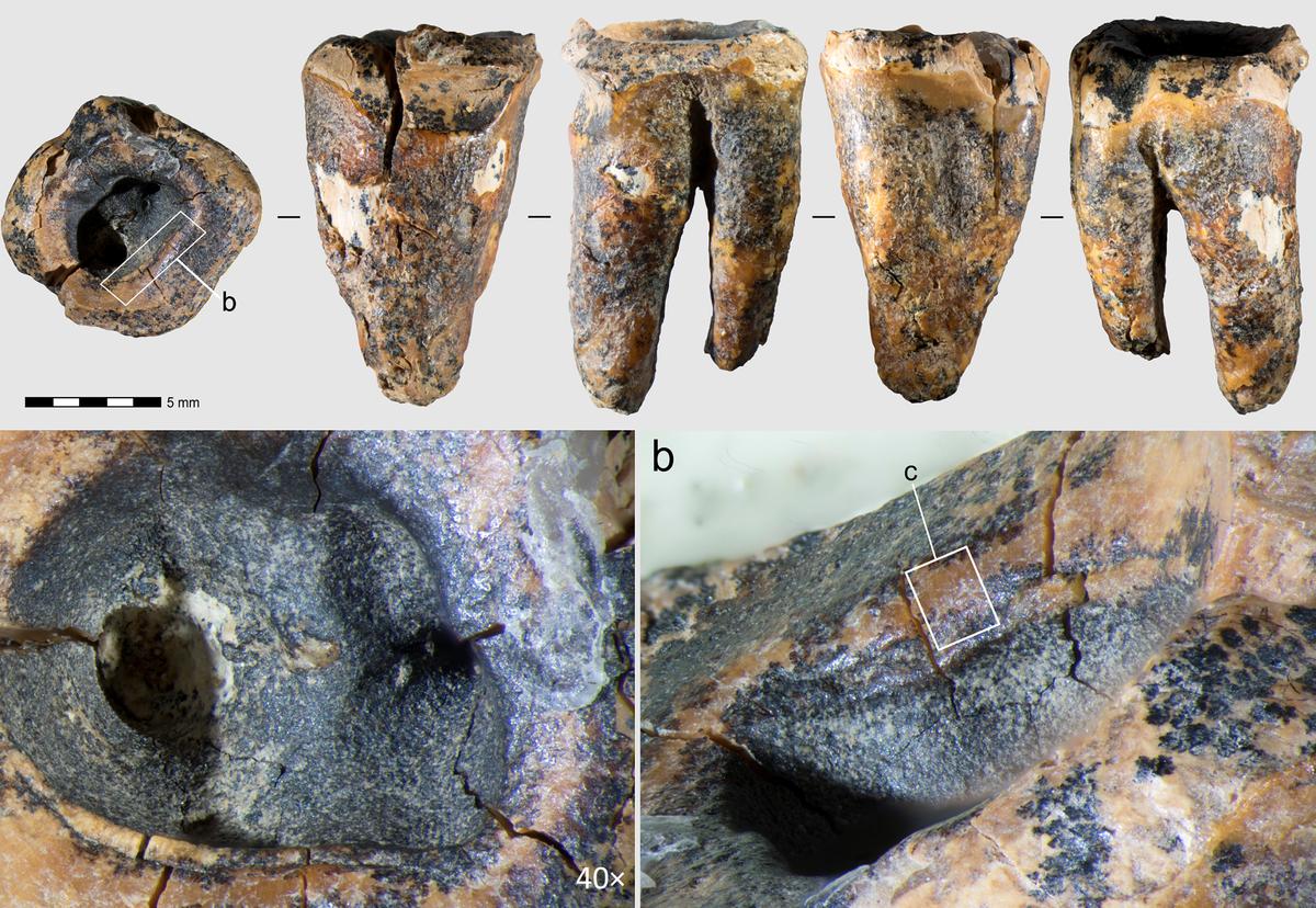 Collage of images showing various parts of the Neanderthal tooth.
