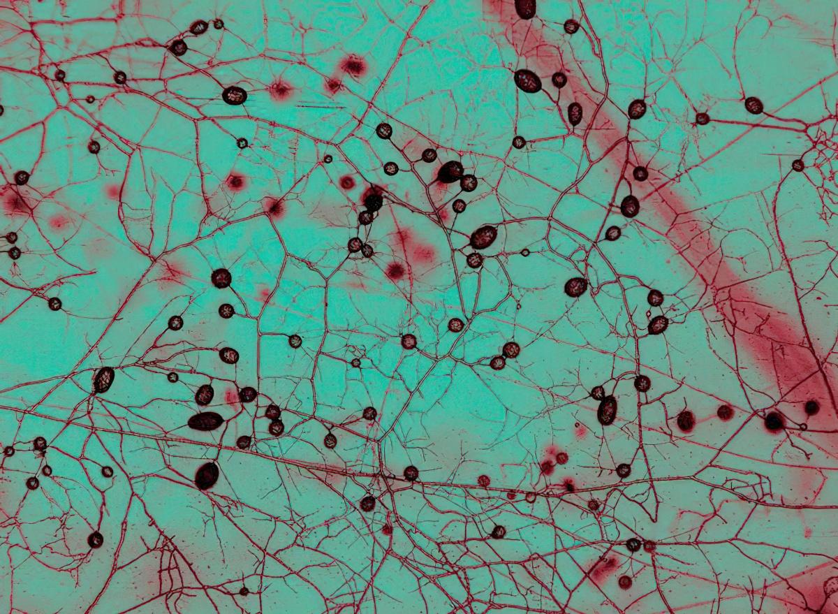 Mycorrizhal fungi seen from Morrison microscope at at AMOLF Institue of Complex Materials, Amsterdam. September 12, 2025. The circular structures are spores. The original photo is black and white, color is altered for legibility.