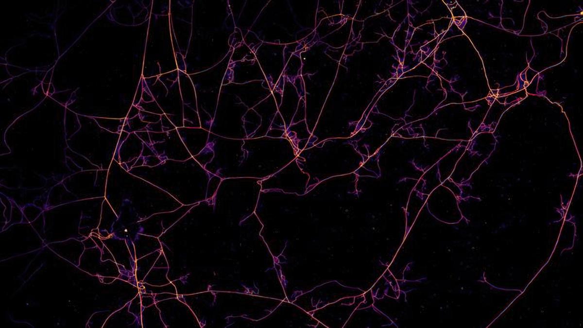 Fungal networks imaged using a microscope at AMOLF biophysics institute in Amsterdam. Threads are arbuscular mycorrhizal hyphae.